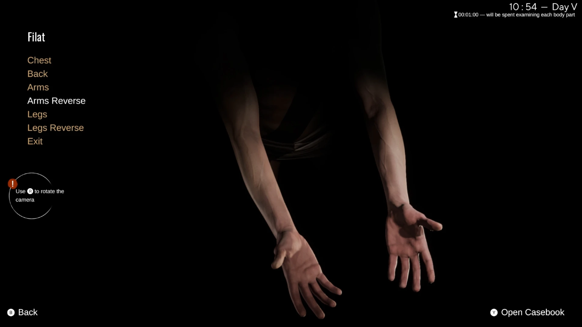 An image of a patient's arms in Pathologic 3: Quarantine.